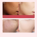 4 in 1 Household Portable Facial Massage Device